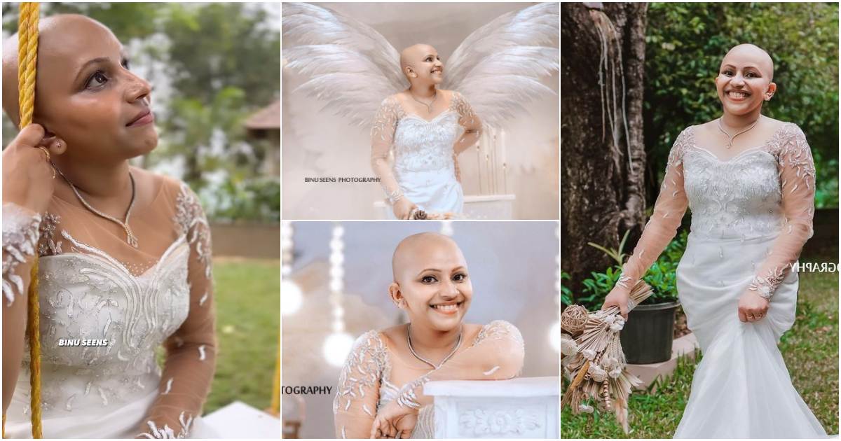 Cancer Survivor Steffy Thomas Wedding Photoshoot Malayalam News