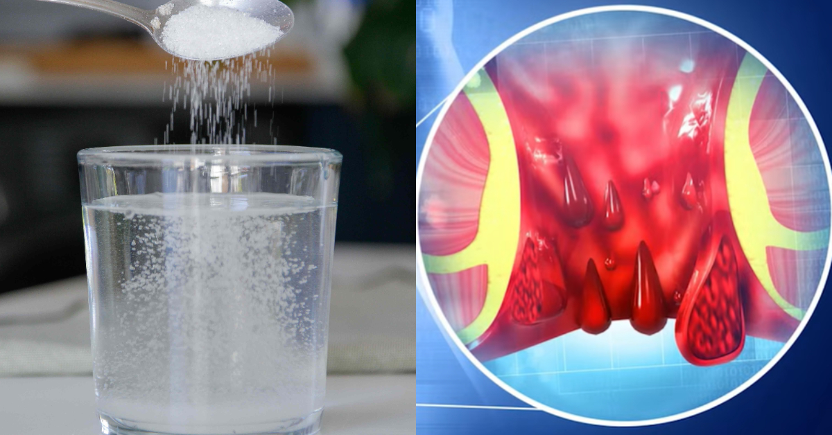 Natural Piles Relief Tips
